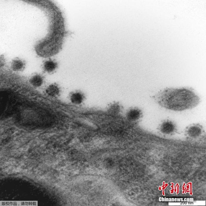 资料图：图为电子显微镜下的新冠病毒“德尔塔”变种毒株。