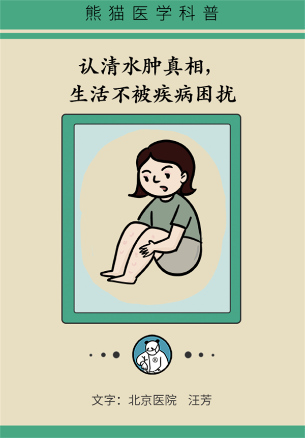 身体出现水肿怎么办？ 专家提醒这四种情况要重视